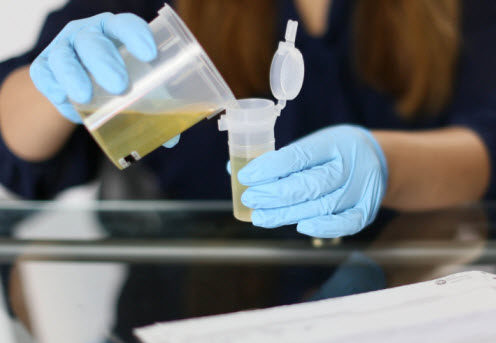 mobile drug testing for Memphis residents. alternative to Concentra urgent care